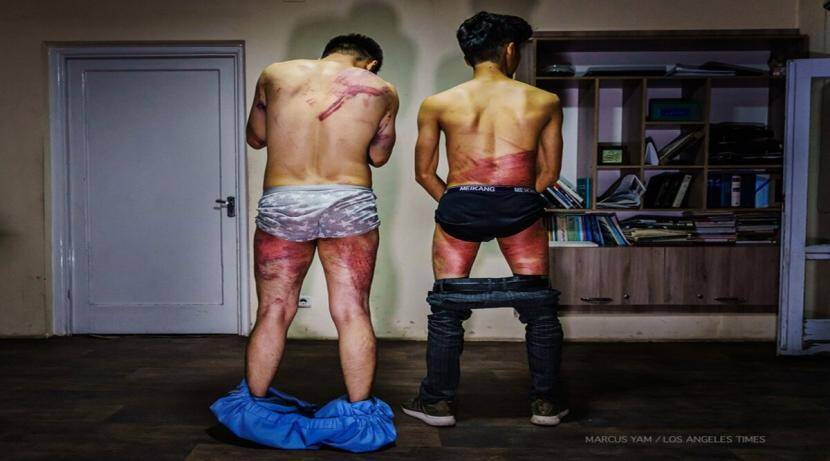 … Inhuman beating of those Afghan journalists by the Taliban; The photo will make you tremble