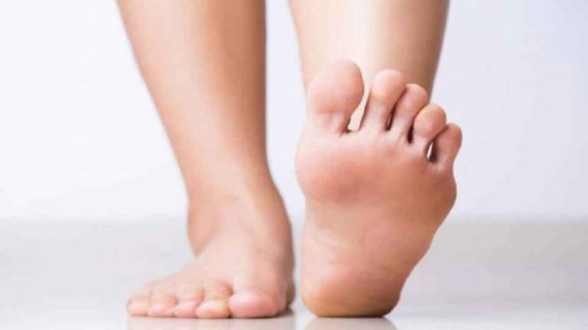 20 percent of citizens suffer from flat feet; Experts appeal not to ignore the disease