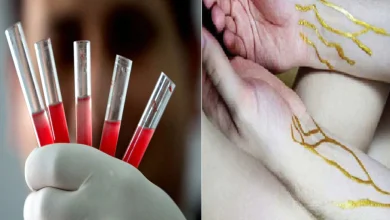 Know the blood group of the gods? Only 45 people in the world have this golden blood type