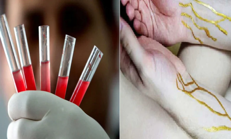Know the blood group of the gods? Only 45 people in the world have this golden blood type