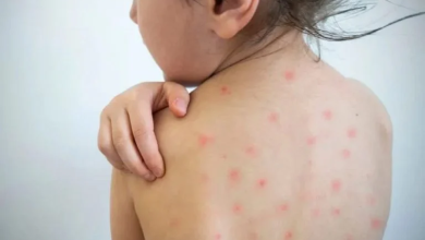 Task force orders: Now even measles patients will be quarantined
