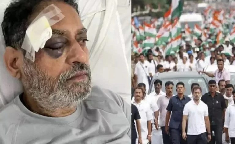 Bharat Jodo Yatra: Major Maharashtra leader seriously injured