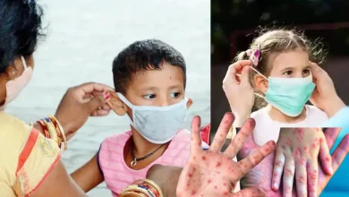 Mandatory masks for children to prevent the risk of measles