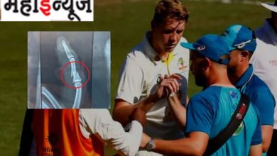 Wow! Cameron Green played 157 balls despite finger injury, Mumbai Indians shared photo
