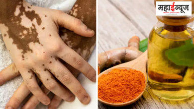 Turmeric, oil, all white spots, without delay, doctor, 4 remedies,