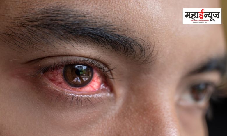 These are the symptoms of eye disease spreading in the state