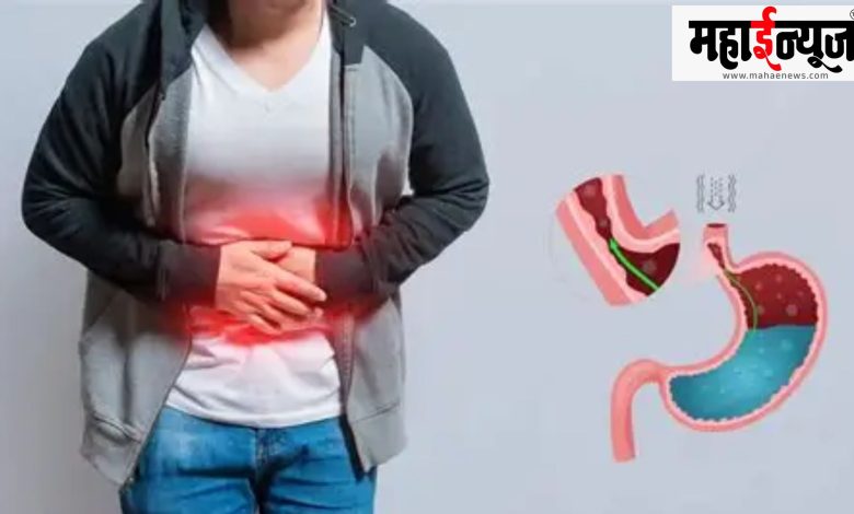 Stomach, gas, indigestion, acidity, powder, useful,Stomach, gas, indigestion, acidity, powder, useful,
